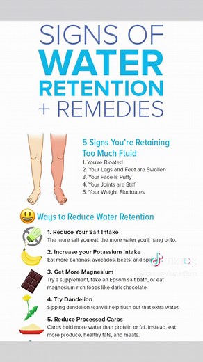 Water retention or #endema is swelling in different parts of body, can be very uncomfortable and annoying 😣. We can have endema most commonly in feet, legs, ankles and hands . Here is a useful post about signs of water retention and #remedies thanks to paleo hacks 🙏✨✔️ #waterretention #waterretentionremedy #waterretentiontips #bloatingremedy #naturalcurestheydontwantyoutoknowabout #healthylivingtips2023 #healthylifestyletips🌿 #trendingnowontiktok🔥 #fypyou #functionalmedicine #naturopathicmed