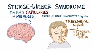 Video: Sturge-Weber syndrome - Video Explanation! | Osmosis | Osmosis