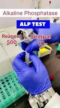 ALP test Alkaline phosphatase test lft test #youtubeshort #short #ALP