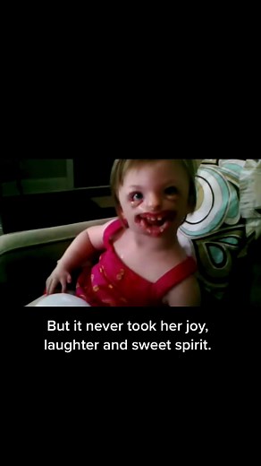 Toddler Sophia's Journey with Rett Syndrome