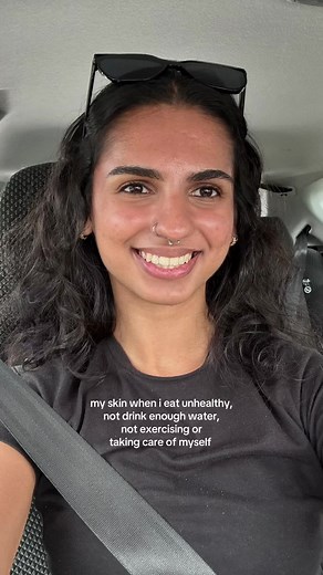 my cystic acne is back with a vengeance #acne #cysticacne #severeacne #hormonalacne #adultacne #lifewithacne #pimples #accutane #solofemaletraveler