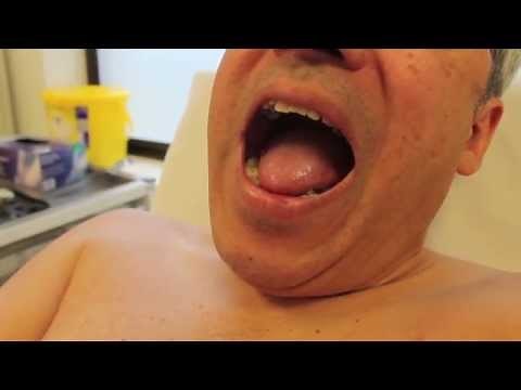 How to look for central cyanosis