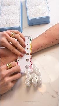 COMO É FEITO O TESTE DE ALERGIA?