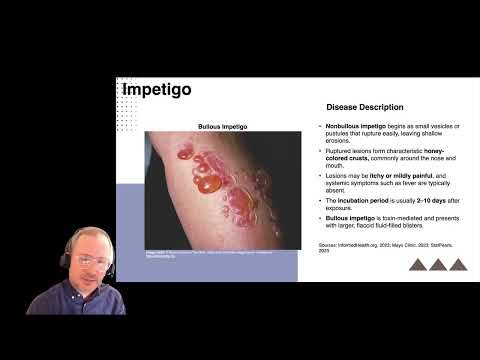 staphylococcal skin infections Hagood