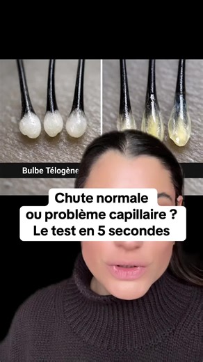 Test rapide pour identifier la chute de cheveux