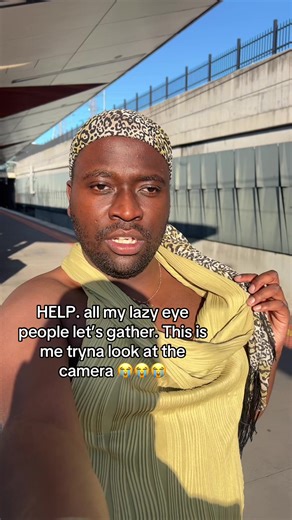 Living with a Lazy Eye: A Relatable Experience