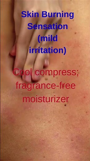 Skin Burning Sensation? Try These Soothing Tips Fast! ❄️