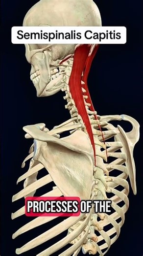 Semispinalis capitis muscle #anatomy