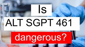Is ALT SGPT 461 high, normal or dangerous? What does Alanine aminotransferase level 461 mean?