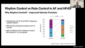 HRS 2025 Insights: Atrial Fibrillation in HFrEF - Rate vs Rhythm Control