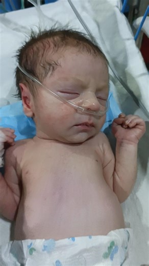 This short video shows an oxygen dependent newborn baby admitted in NICU 👶🏥