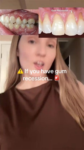 Careful if you have gum recession | theshoptheory | Facebook