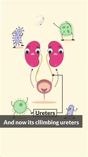 Our memory music helps nursing concepts stick 🤣 Listen for free in our bio! #nursing #nurse #uti