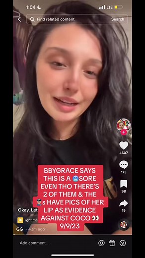 *This is a no hate post* this is a public story. coco was arrested for a$$ault, w phys!cal bod!ly injury. Grac3s lip being of the injuries, so why come online and say you have buurrrsores? Im confused. *again its not a hate post, just wondering why on paper these lip wounds were from coco but online she has coldsor3s* ☺️💗 #fyp #coco #bbygrace #bbygraceandcoco