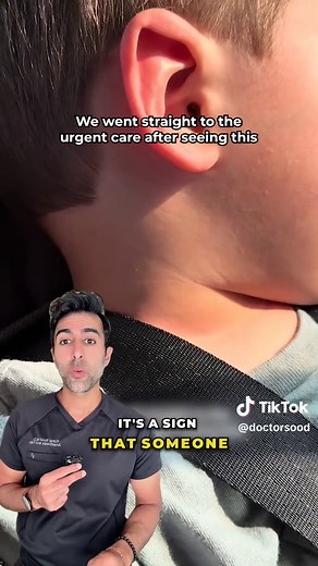 Supraclavicular retractions are a visible sign that someone is working hard to breathe. They happen when the airway is narrowed or blocked, forcing the body to generate more negative pressure to pull air in. This can signal serious distress, especially in young children. VC: @mckinsea #medical #health #healthtips #retractions #respiratorydistress #airway #pediatrics