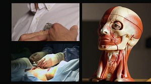 BBC Two - Trust Me, I'm a Doctor, Series 7, Episode 5 - The new nerve stimulation therapy for stroke survivors