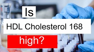 Treatment and symptoms of HDL cholesterol 168 mg/dL | Diet for high HDL cholesterol level 168 mg/dL