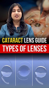 Choosing the right lens for cataract surgery is key to better vision #cataractlens #cataractawareness #cataracttreatment #cataractsurgery #trendingvideo #eyehospital #eyecaretips #eyehospital | EYE Mantra | Facebook