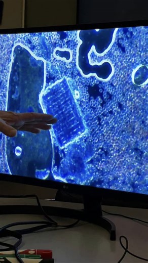 One of our greatest finds yet , captured a couple of years ago under dark-field microscopy. This structure appeared inside the blood, a perfect rectangular grid unlike anything from natural biology. Could we be witnessing nanotechnology forming within the bloodstream? Is this the elusive 12-bar chip, a geometric design surrounded by a gel-like matrix, appearing to interact with and harvest red blood cells? Whatever it is, it challenges everything we thought we knew about what flows through us. T