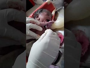 “Newborn Resuscitation & Umbilical Cord Care | Educational Medical Training Video”