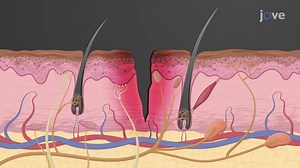 Video: Inflammatory Response
