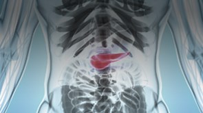Pancreatic Cancer: Associated Signs, Symptoms, Risk Factors and Treatment Approaches