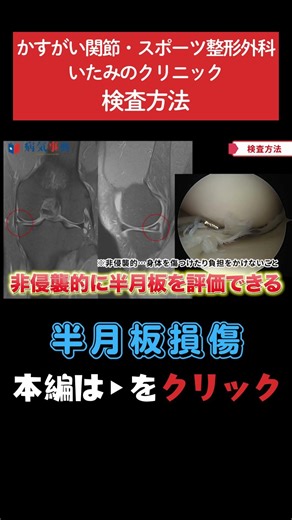 [Meniscus Injury] What is the examination for a meniscus injury? #meniscusinjury #kneepain #kneej...