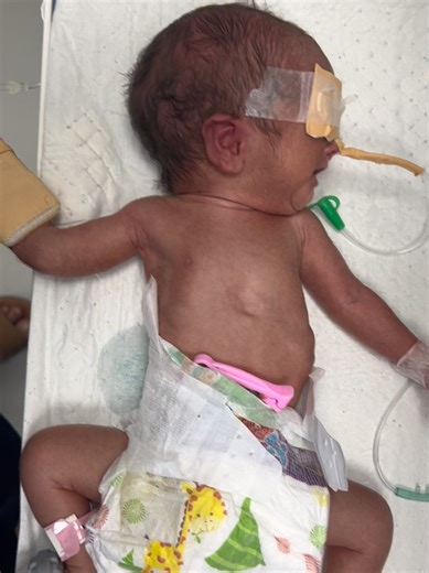 Baby Feeding Challenges: Understanding Newborn Needs