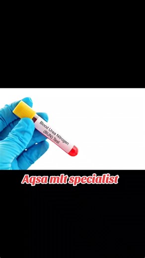 Serum Urea Test (BUN) #urea #ureatest Follow for more informative content❤️#information #medicaldoctor #wbccast #cast #urinemicroscopy #aqsamltspecialist #aqsa_mlt_specialist #foryou #fypシ #foryoupage #microscopy #learnwithaqsa494 #labdoctor #medicalstudent #health #microbiologia #lab #follow #dmlt #test #bloodtest #microbiology #mlt #blood #bwp #bahawalpur #hospital #medical#nursing #nursingstudent #mlt #bmlt #medicallabtechnologist #labrador #labwork