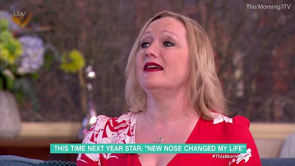 Shocking moment woman removes her prosthetic nose live on air