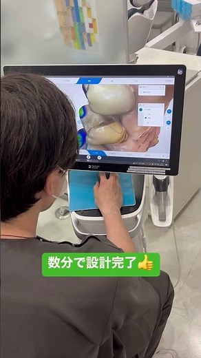 [セレック1day]１日で白い詰め物が入る治療の流れ🦷
