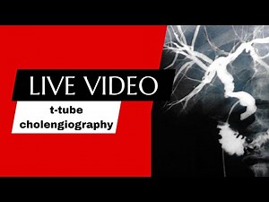 t-tube cholangiography procedure ‪@radiologytechnologistamir‬ ‪@RadiologyClasses‬ ‪@MicroStrategy_US_2023.‬