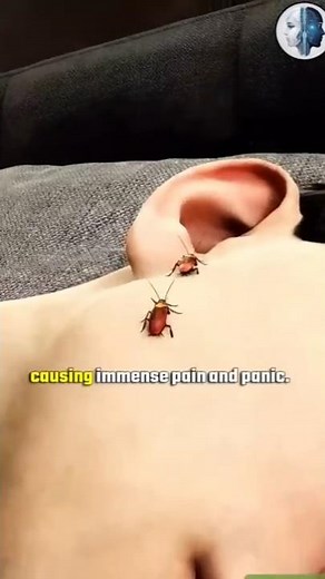 What If YOUR Ear Has Cockroaches!?😨 #cockroach #shorts #shortsfeed