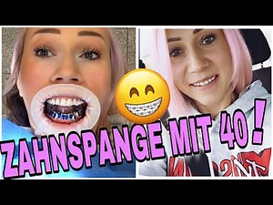 INSERTING FIXED BRACES😰 PROCESS FOR BONDING BRACKETS & TREATMENT - METAL or CERAMIC?