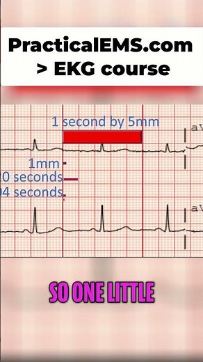 EKG Interpretation: Understanding the Small & Big Boxes