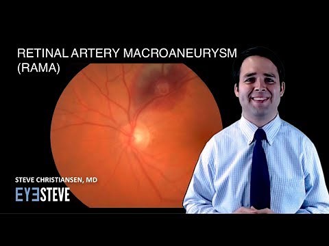 Retinal Artery Macroaneurysm (RAMA)