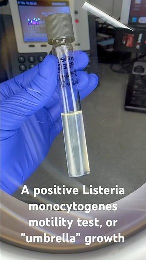 A positive Listeria monocytogenes motility test #microbiology #listeria #umbrella #scientists