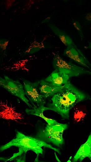 TAMU Biomedical Engineering on Instagram: "“We’ve essentially taught healthy cells to share their spare batteries,” says Dr. Akhilesh Gaharwar. Researchers in the Gaharwar lab have discovered a breakthrough that could open new possibilities for treating degenerative diseases like Parkinson’s and Lou Gehrig’s disease. By exposing stem cells to specially formulated microscopic flower-shaped particles called nanoflowers, Dr. Gaharwar, PhD student John Souka and their fellow researchers found that t