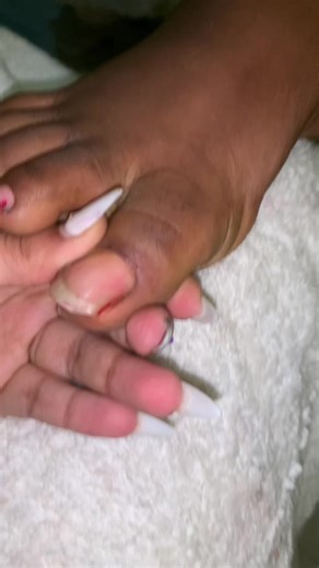 Anfo. 0911636450 0944234397