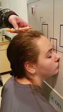 Rhese Method Optic Foramen Orbits 1