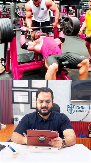 This Is How a Pectoral Tear Looks in Real Life #gym #injury #chest