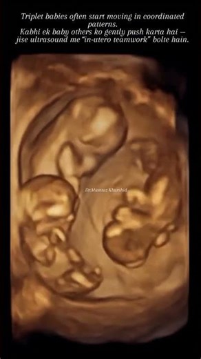 Cute Triplets Baby Movements in a Coordinated Way