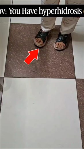 This Girl's Hands Has hyperhidrosis