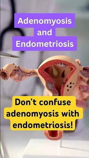 Adeno is NOT the same as Endo. Here’s why
