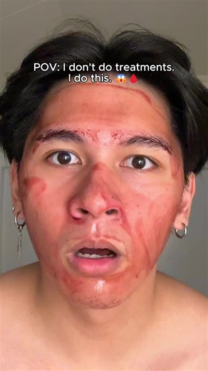 G2G Peeling Solution Explained: How It Works