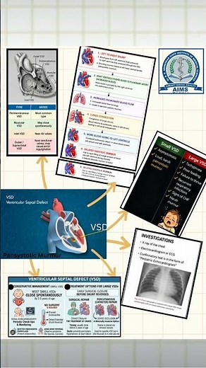 Ventricular Septal Defect (VSD) Explained: Types, Symptoms & Treatment