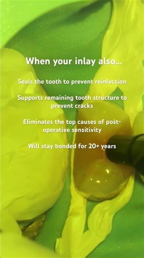 Improve your inlays, onlays and overlays