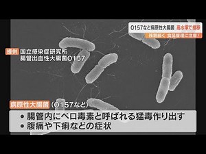 腸管出血性大腸菌（O157）高水準で推移 今年に入り24人感染 残暑が続き食品管理に注意を