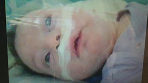 Scriam zilele trecute despre boli acute de sezon la copiii mici. Despre gripă și VSR (virus sincițial respirator) drept principală cauză de supraaglomerare a serviciilor de urgență la copil în aceste zile. Astăzi la noi la Urgențe au fost peste 100 de copii cu febră și tuse. Mai mici sau mai mari, bolnavi de câteva ore sau de multe zile. Cu siguranță foarte mulți... Atât de mulți încât după orele prânzului erau aproape 30 de pacienți în triaj, in așteptare. Ce ar trebui să facă părinții pentru c