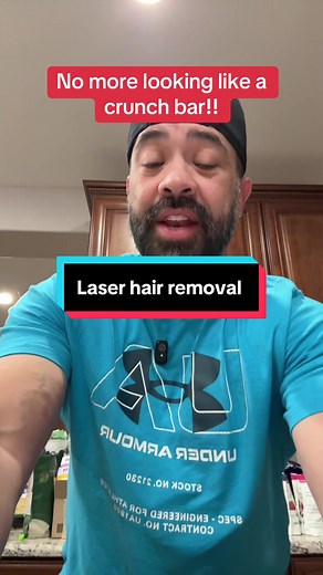 Laser hair removal